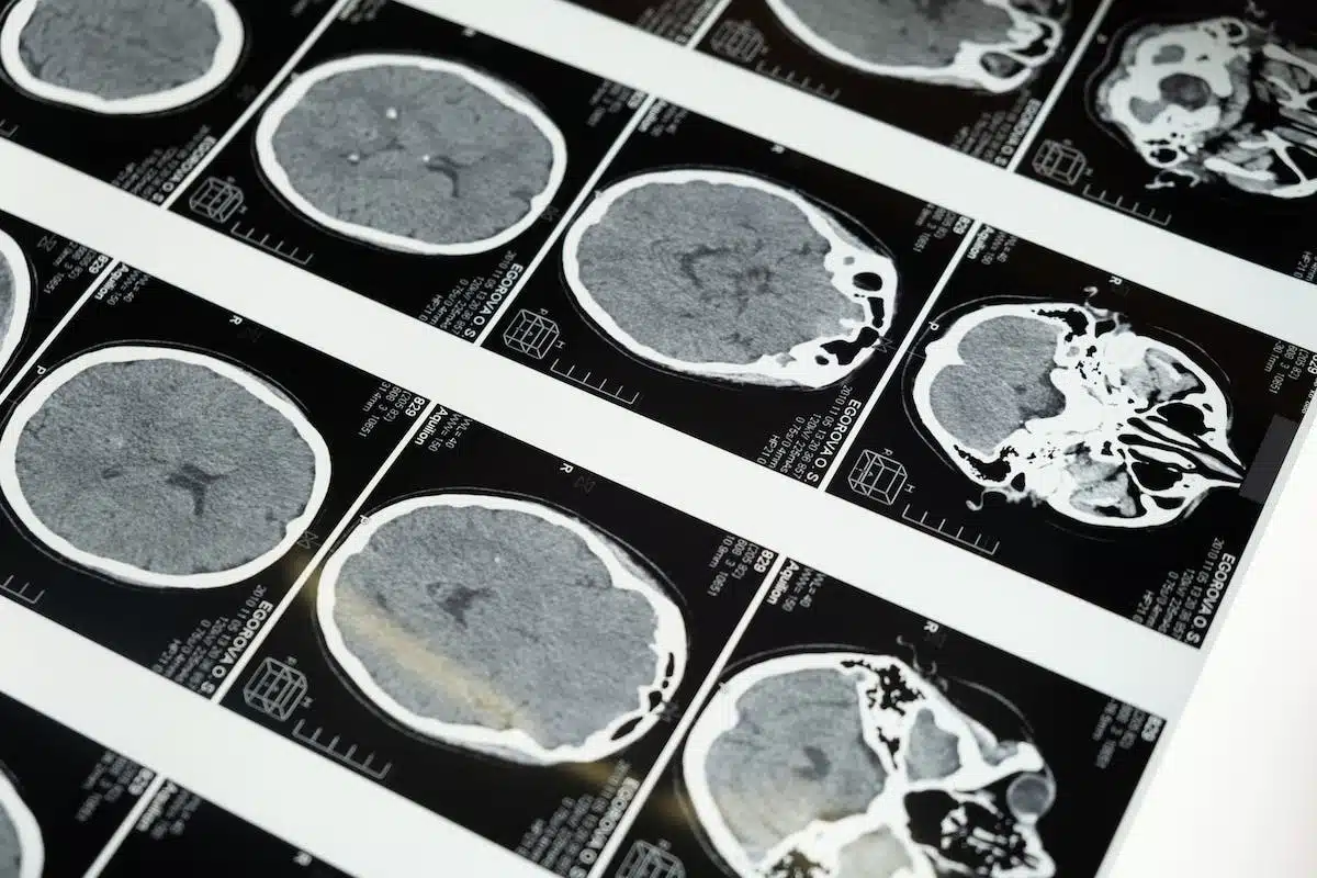 cerveau  recherche